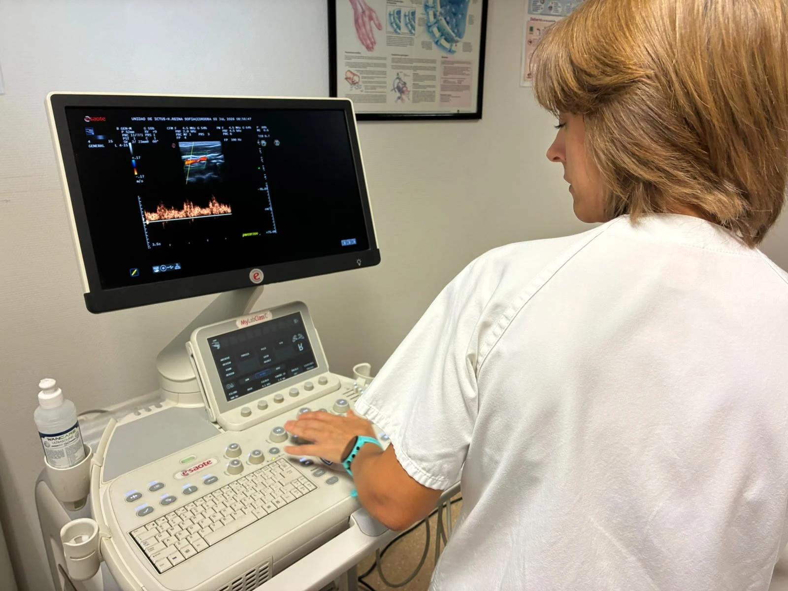 Diagnóstico de ictus más rápido con Doppler en consulta