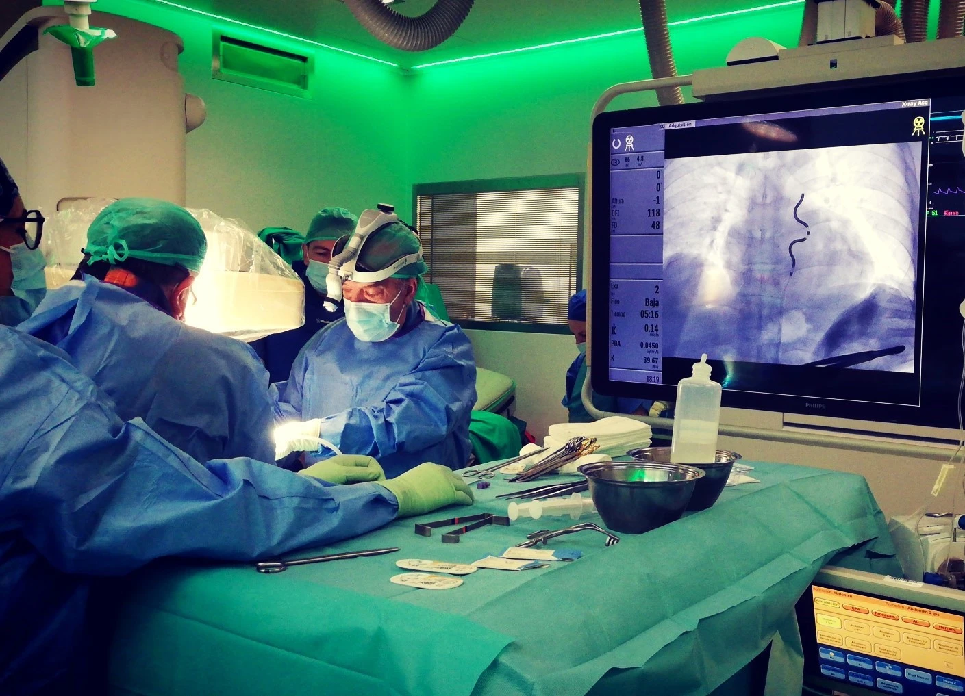 Quirónsalud Córdoba implanta con éxito el primer desfibrilador extravascular retroesternal en un hospital privado de España